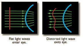 How wavefronts technology works in custom lasik treatments.